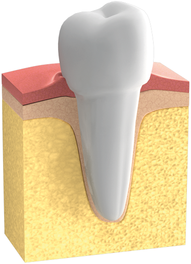 Parodontologie : Gesundes Zahnfleisch